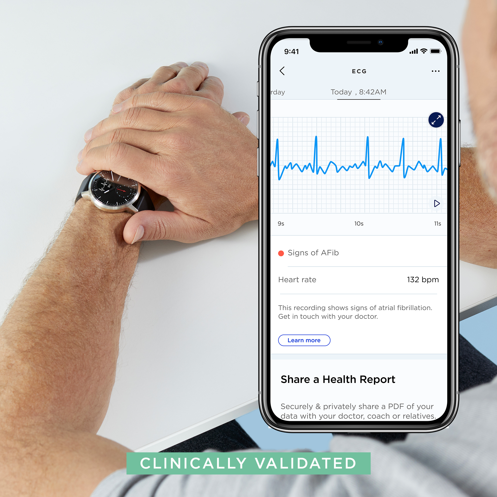 Withings ScanWatch 心臟健康監測智能手錶 (白色42mm)